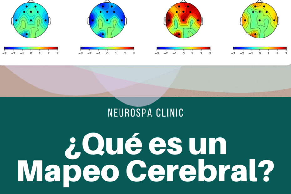 Mapa cerebral EEG mostrando patrones de ondas cerebrales Alpha, Beta, Theta y Delta. Imagen promocional de NeuroSpa Clinic para explicar qué es un Mapeo Cerebral y cómo ayuda a guiar tratamientos personalizados para ansiedad, depresión, TDAH y otros trastornos.