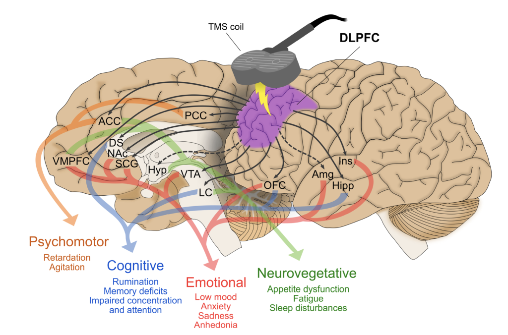 Figura 2 de Anderson y colaboradores: conexiones anatómicas de la corteza prefrontal dorsolateral con regiones implicadas en dimensiones de síntomas depresivos.